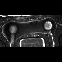 tissue segmentation project thumbnail