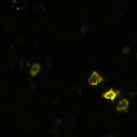 yellow cells project thumbnail
