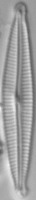 Diatom Classification project thumbnail