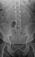 LUMBAR project thumbnail