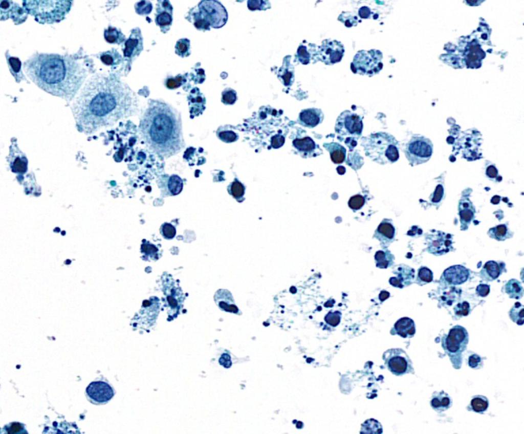 urine cytology cell detection Object Detection Dataset by National ...