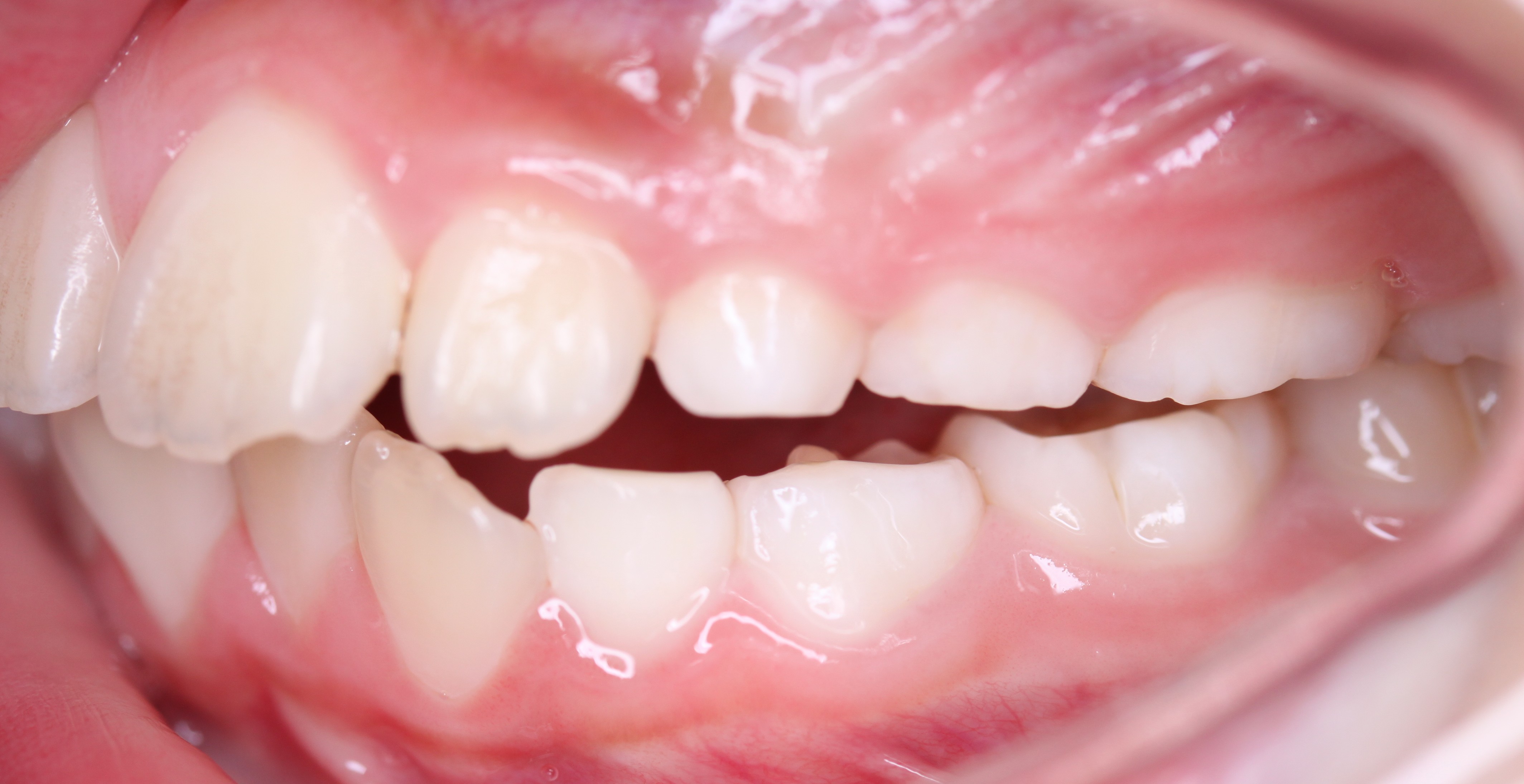 tooth-photo-check-6.7 Classification Model by Dental Examination