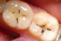 Dental Examination project thumbnail