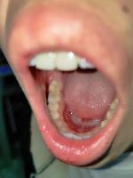 the tihrd molar project thumbnail