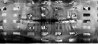 A2_Augmented_Max900 project thumbnail