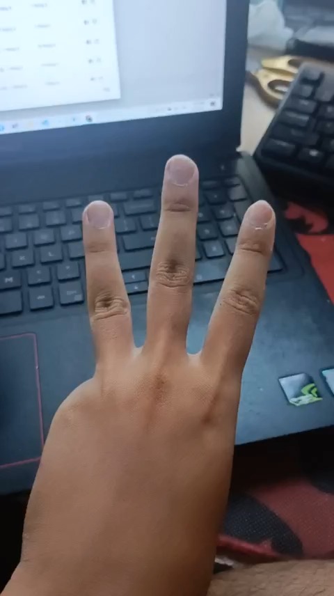 Hand Segment Instance Segmentation Dataset by Nguyn Trn Bo Long