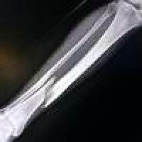 bone crackkk seg project thumbnail