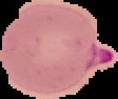 parasitmalaria project thumbnail