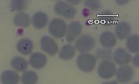 Find anaplasmas, babesias, theilerias, trypanosomas and Trypanosomas project thumbnail