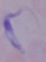 Parasit Detection project thumbnail