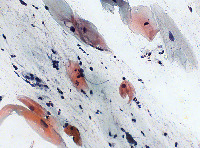 pap-smear-binary project thumbnail