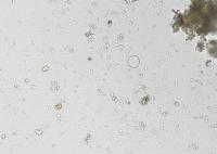 E.coli project thumbnail