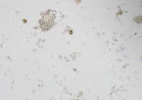 E. histolytica NSS project thumbnail