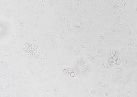 ฺB. hominis project thumbnail