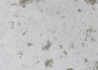 E. coli project thumbnail