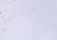 Total project thumbnail