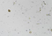 G.duodinalis project thumbnail