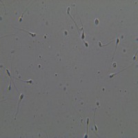 spermskuy project thumbnail
