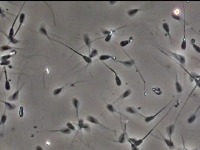 spermskuy project thumbnail