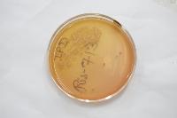 Baacteria detection project thumbnail