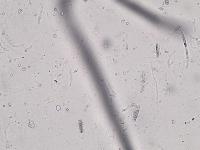 urine-analysis1-2lol7-onpk project thumbnail