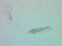 Urine project thumbnail
