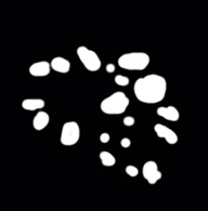 follicle-detection project thumbnail