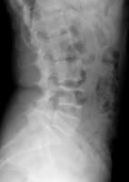 lumbar_seg project thumbnail