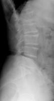 lumbar_seg_fit project thumbnail