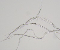 complex-fibers-20x project thumbnail