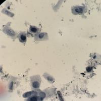 Triticum mitosis project thumbnail