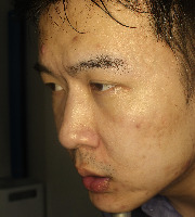 Dataset Image