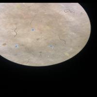 microplastic detection Object Detection Model by microplastic