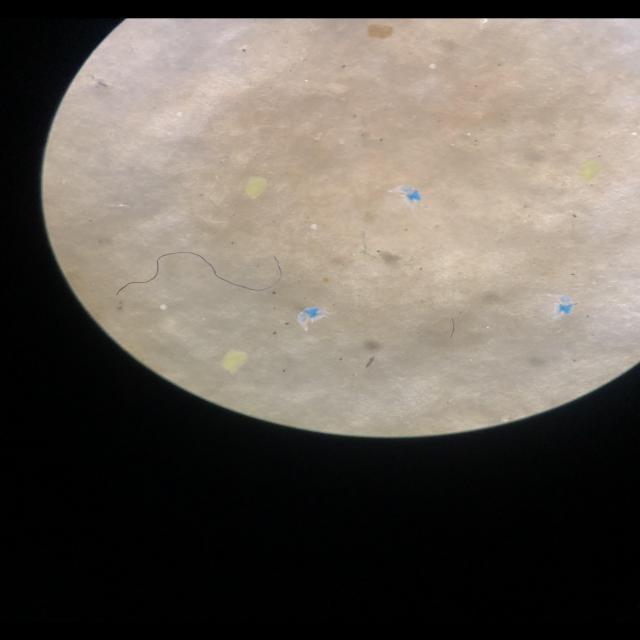 microplastic detection Object Detection Model by microplastic