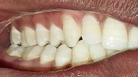 cavity project thumbnail