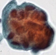 urine cell classification project thumbnail