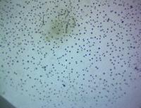 Caenorhabditis Elegans detection project thumbnail