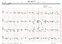STEMI Screening model project thumbnail