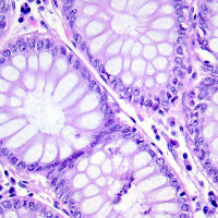 lungs and colon classification project thumbnail