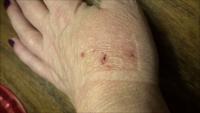 firstaid_4class 2 project thumbnail