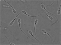 sperm-stage2 project thumbnail