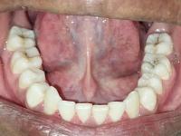 MANDIBULAR project thumbnail