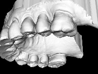 Tooth Annotation project thumbnail