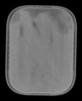 KeyCan w\hole project thumbnail