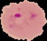 Deteksi Malaria project thumbnail