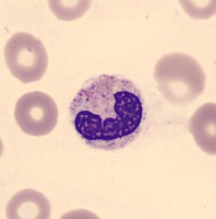 blood cell detection Object Detection Model by Blood cells detection