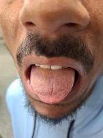 TongueFront project thumbnail