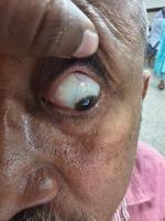 Sclera project thumbnail