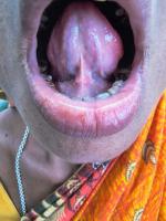 Tongue Back project thumbnail