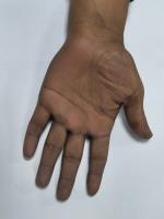 PalmDetection project thumbnail